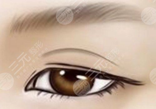 蘇州鄧哲雙眼皮