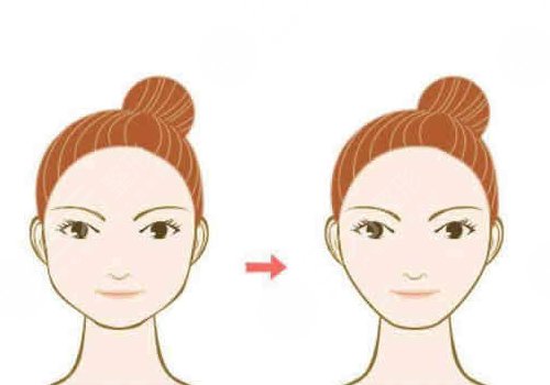 顴骨內(nèi)推老了會(huì)怎么樣