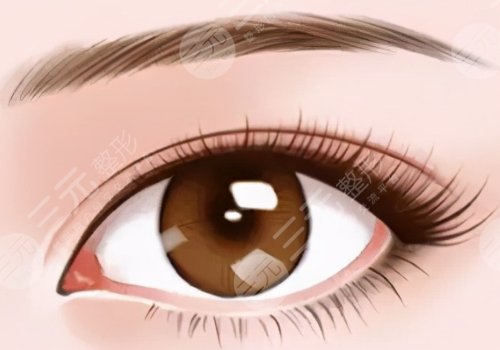 佛山市一醫(yī)院做雙眼皮好不好