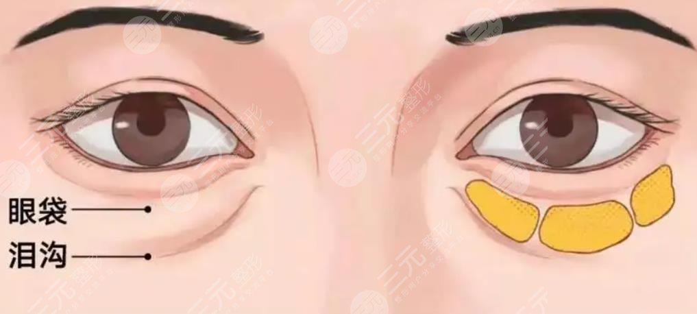 眼底啊