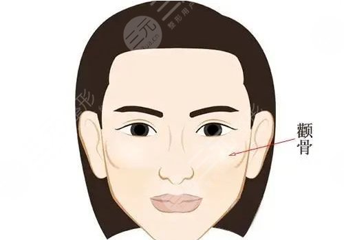 顴骨高磨骨手術(shù)需要多少錢