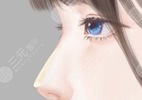 范榮杰做鼻修復(fù)怎么樣