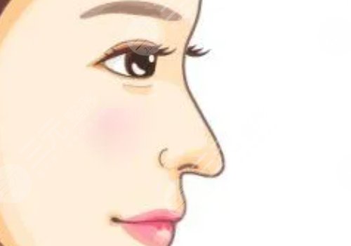 賈德淵做的鼻子怎么那么貴