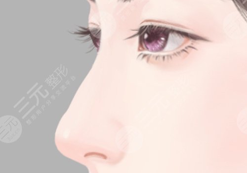 李從從隆鼻案例