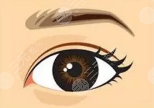 馬希達(dá)醫(yī)生雙眼皮圖片
