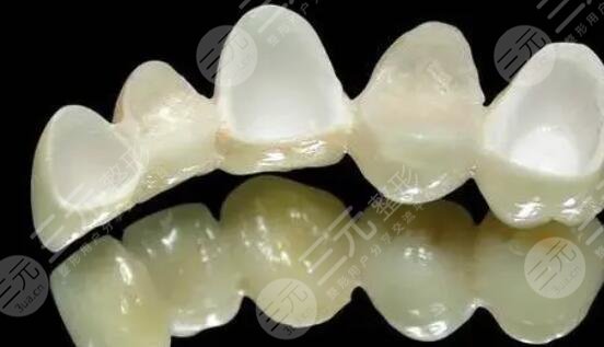 全瓷牙