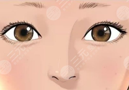 雙眼皮修復(fù)成單眼皮