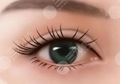 雙眼皮修復(fù)的價(jià)格