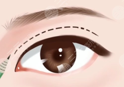 懷化曹家整形醫(yī)院院長