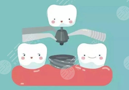 西安美萊口腔怎么樣