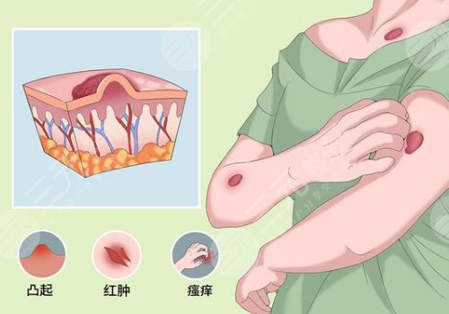 河南中醫(yī)藥大學(xué)第一附屬醫(yī)院整形外科瘢痕疙瘩