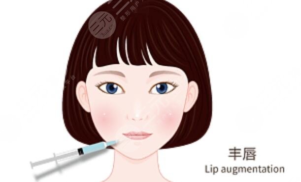 紋唇手術