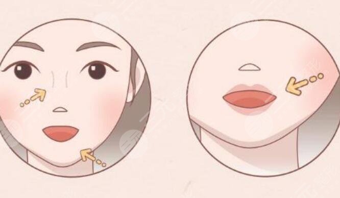 紋唇手術