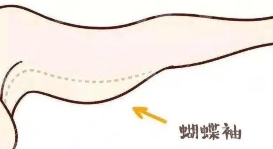 蝴蝶袖