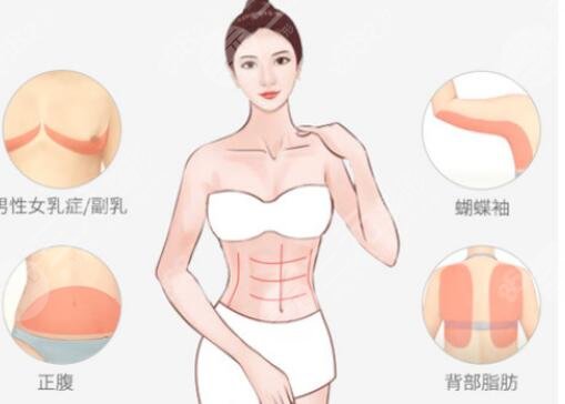 蝴蝶袖