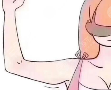 蝴蝶袖