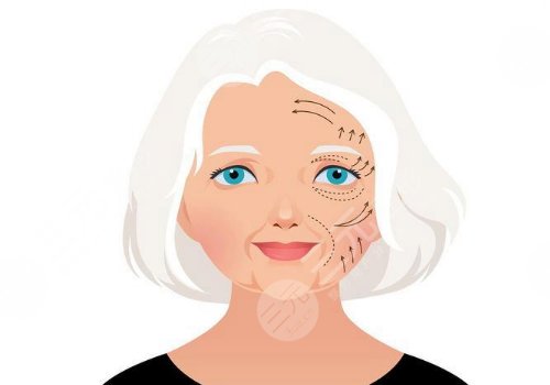 王志堅醫(yī)生小拉皮提升做的怎么樣