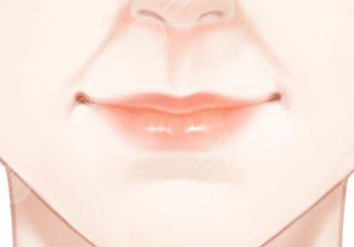 李勁良醫(yī)生鼻基底是用膨體嗎