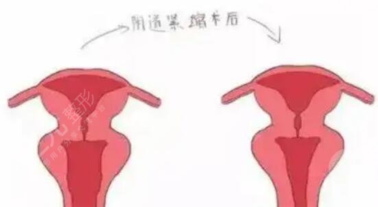 私密