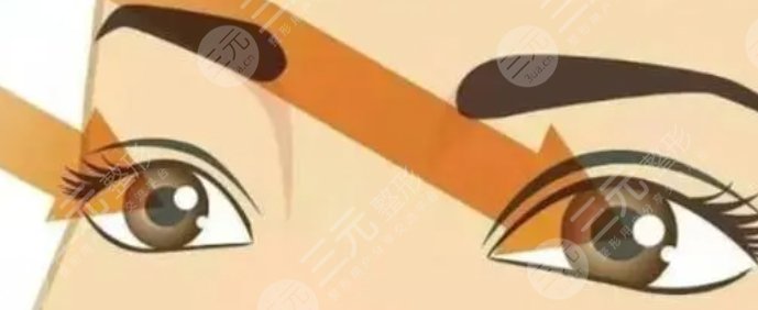 雙眼皮修復(fù)