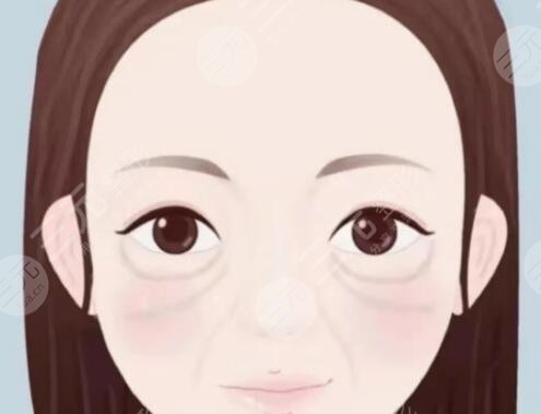 眼窩填充