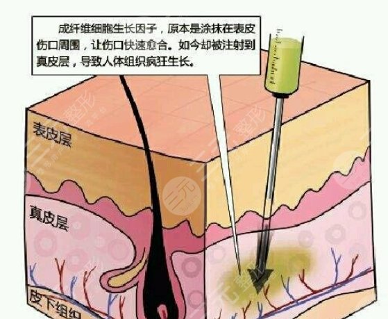 取出