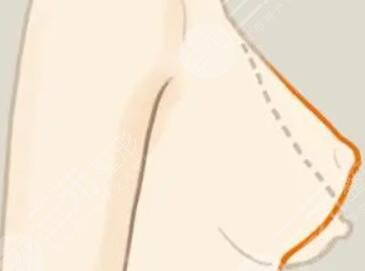 縮胸