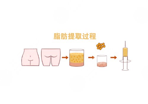 北京協和醫(yī)院夏澤楠醫(yī)生臉部整形怎么樣