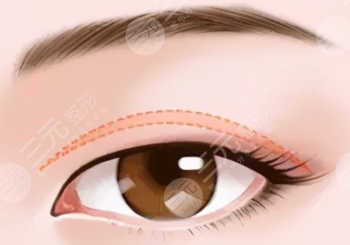 浙大二院陳文才簡介公開