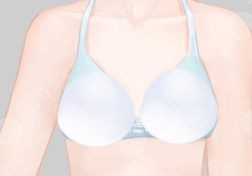 沈陽醫(yī)大附一院隆胸怎么樣