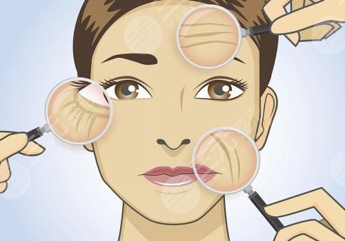 深圳藝星李高峰拉皮怎么樣