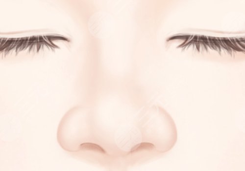 長沙華韓鄧穎縮鼻翼技術(shù)可以嗎