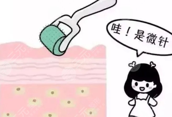 微針