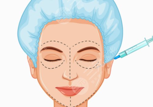 陳貞宜醫(yī)生技術優(yōu)勢