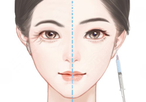 陳貞宜醫(yī)生技術優(yōu)勢