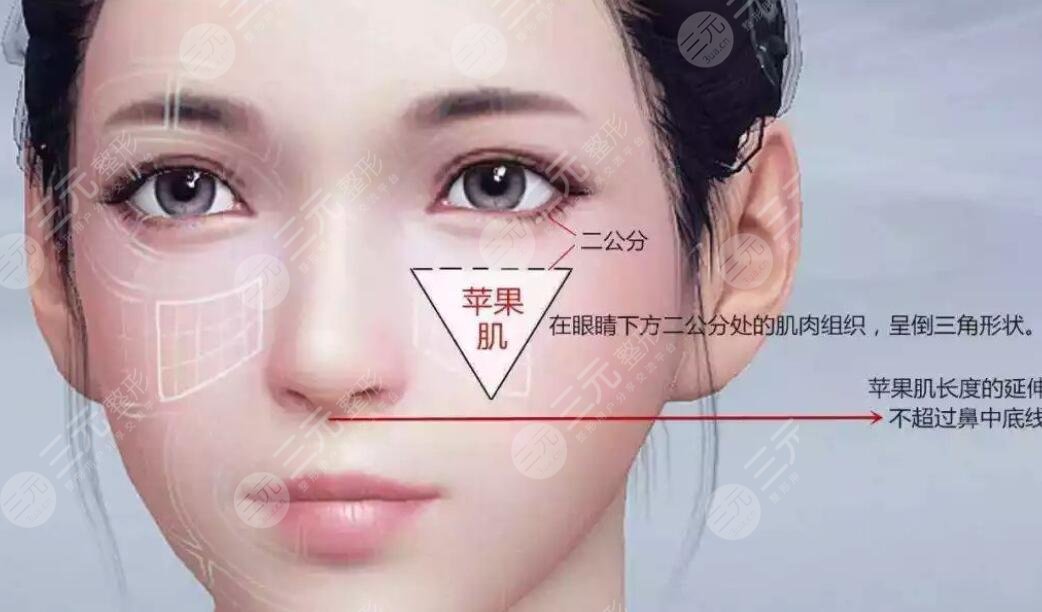 蘋(píng)果肌