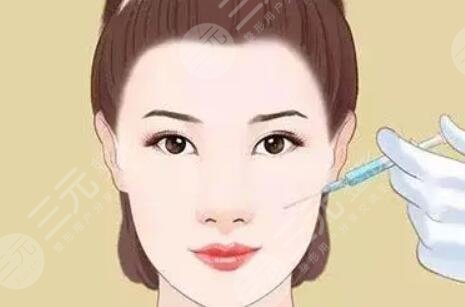 蘋(píng)果肌