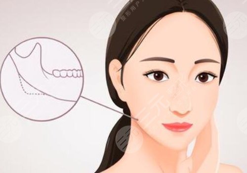重慶華美磨骨