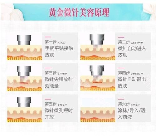 痤瘡疤痕修復(fù)、私密年輕化