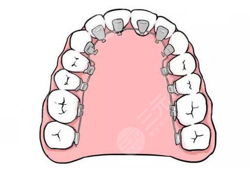 上海醫(yī)大醫(yī)院牙齒矯正費(fèi)用