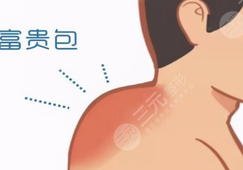 武漢陳克富貴包