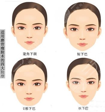 怕疼/快速?gòu)?fù)工黨