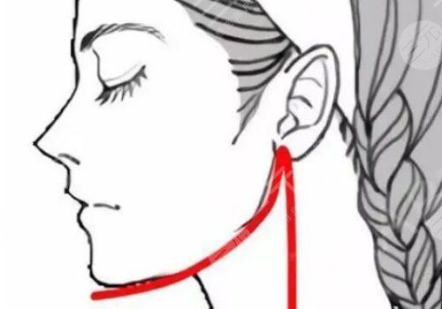 貴州醫(yī)科大學(xué)附屬醫(yī)院下頜角手術(shù)